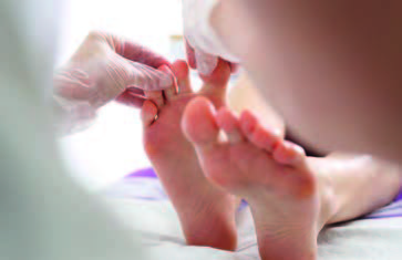 Salute dei piedi: le patologie podologiche più comuni
